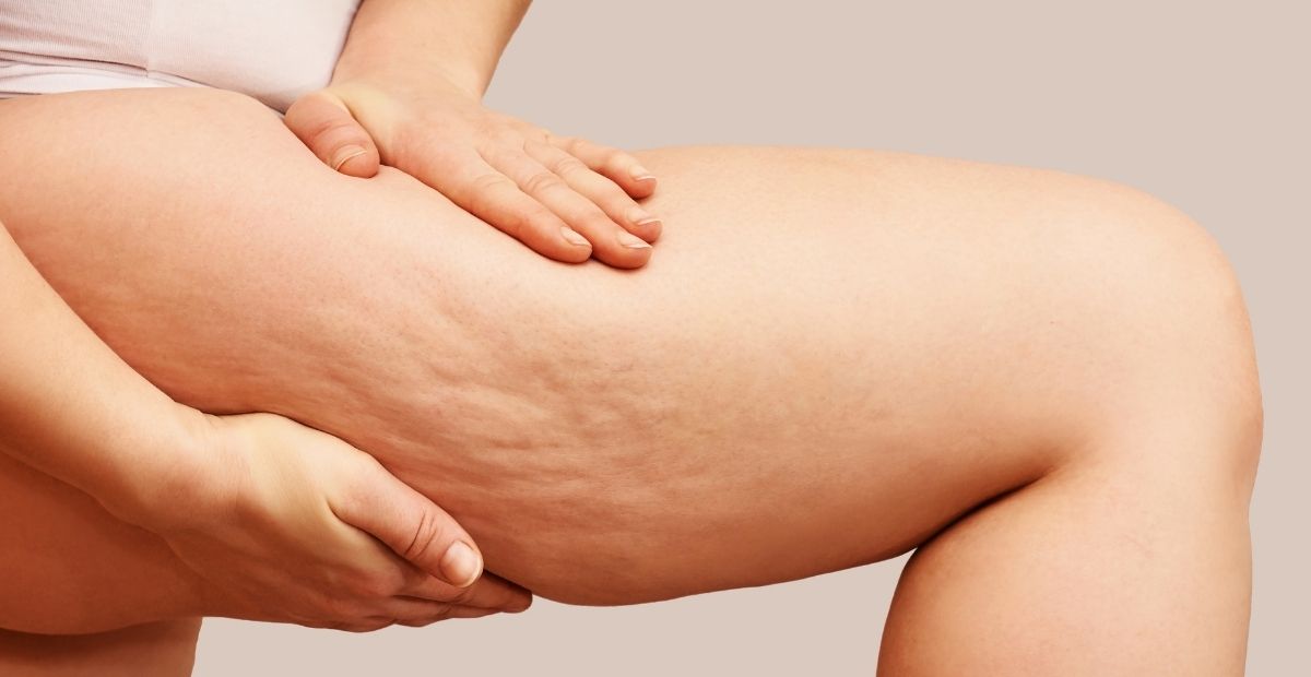 Consigli e suggerimenti utili per combattere (e risolvere) il problema della cellulite evitando che possa peggiorare