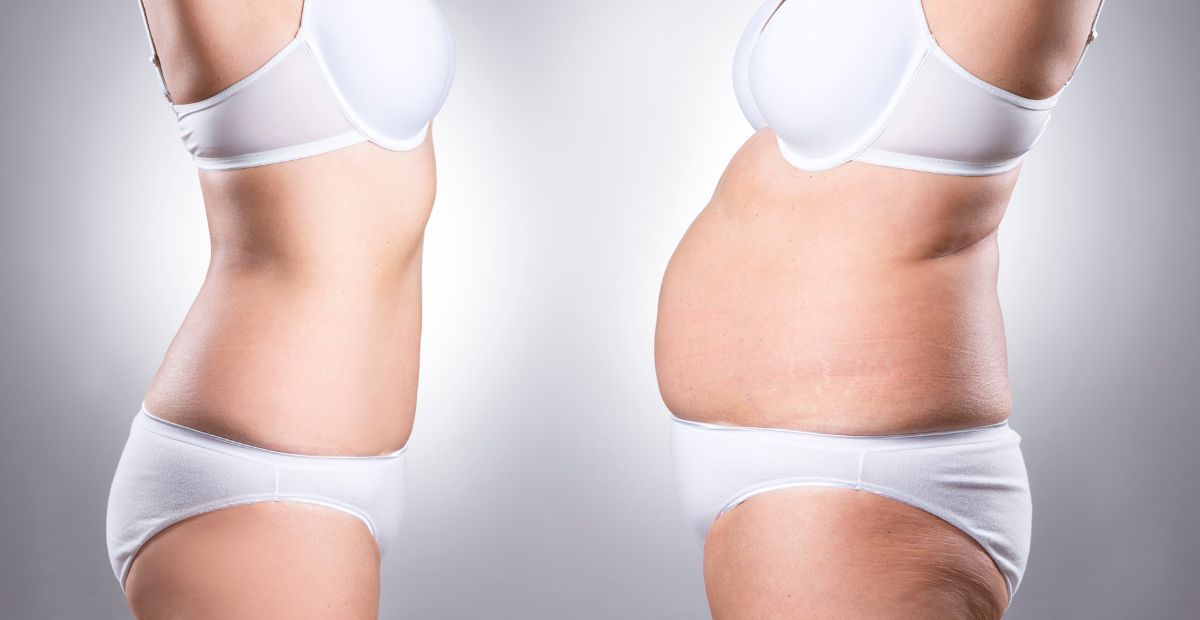 Vorresti rimodellare il tuo corpo? Con il trattamento LPG corpo, puoi finalmente dire addio a cellulite, gonfiore e adiposità localizzate