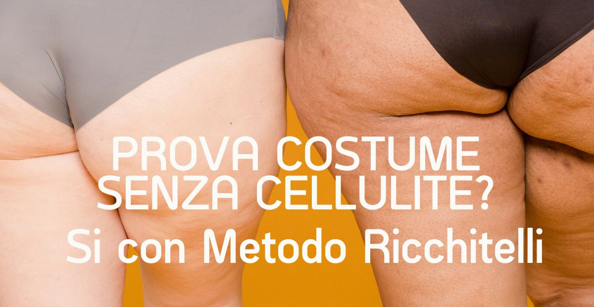 Cellulite difficile da eliminare? Scopri come superare la prova costume con il Metodo Ricchitelli. Prenota la tua consulenza gratuita ora.
